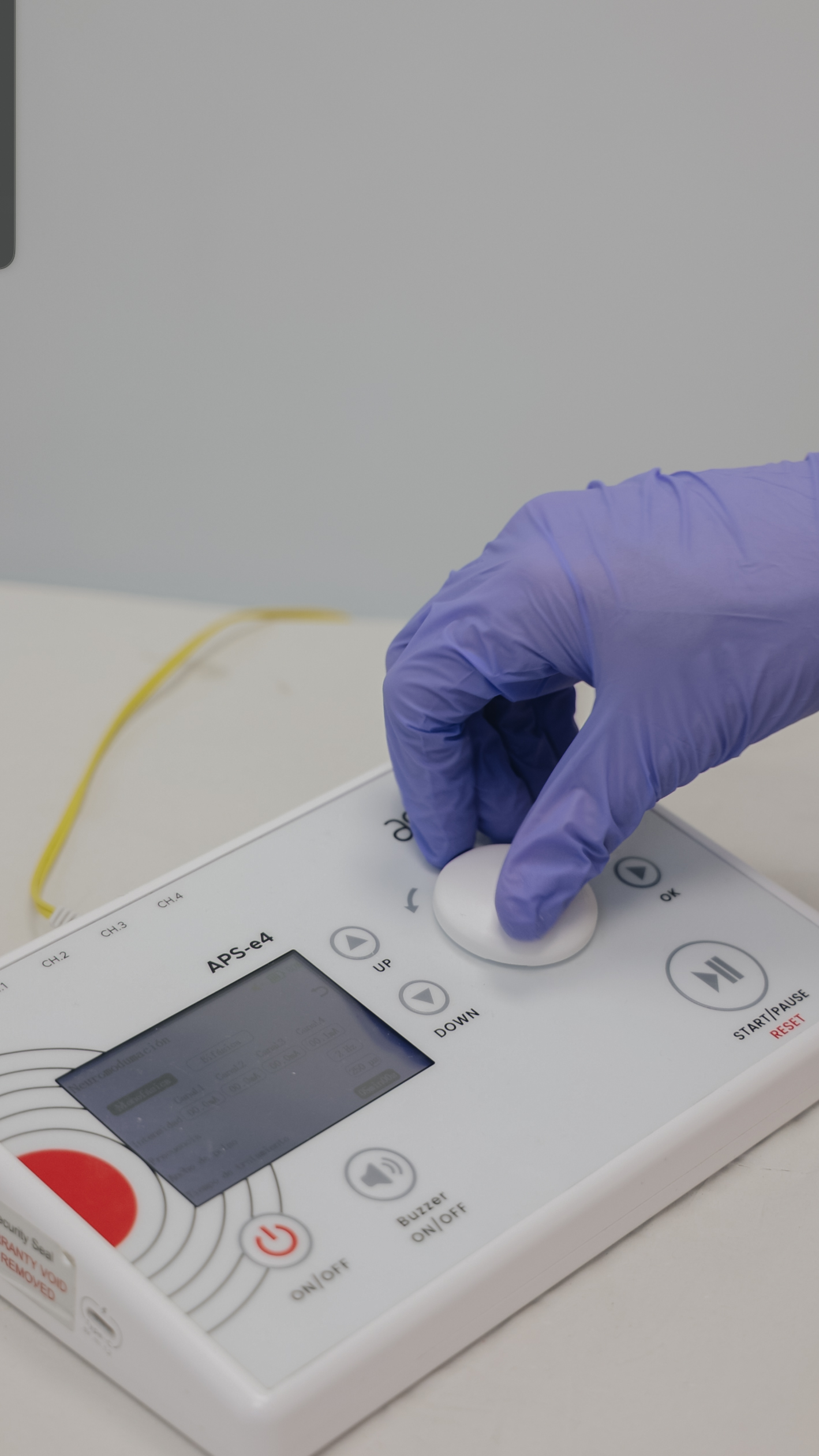 Neuromodulación percutánea guiada por ecografía en sesión de fisioterapia avanzada en Evolucenter Móstoles para tratamiento de dolor neuropático